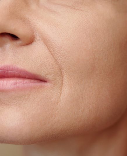 Mature woman with nasolabial folds, selective focus