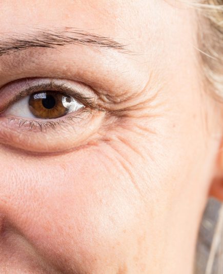 Macro of the eye of a smiling woman showing signs of age such as crow's feet and wrinkles