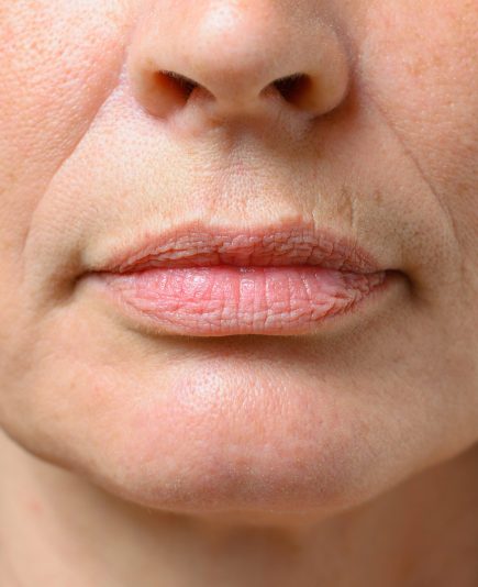 Closeup on the mouth of a middle-aged brunette woman with her mouth closed and a serious expression