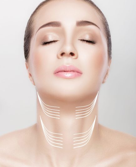 woman with arrows on her neck. lifting concept. correction of double chin